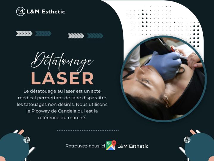 Détatouage Laser
