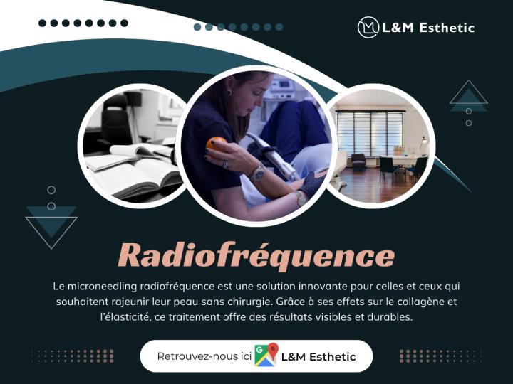 Radiofréquence